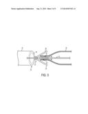 STENT DELIVERY SYSTEM AND METHOD diagram and image