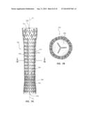 REINFORCED VALVE diagram and image