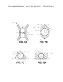 TRANSCATHETER VALVE REPLACEMENT diagram and image