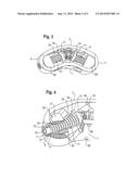 EXPANDABLE INTERVERTEBRAL IMPLANT diagram and image