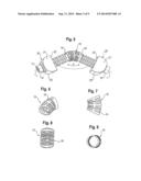 EXPANDABLE INTERVERTEBRAL IMPLANT diagram and image