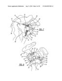 Modular Glenoid Base plate With Augments diagram and image