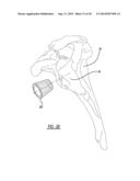 Modular Glenoid Base plate With Augments diagram and image