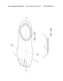 SMOOTH ROLLOVER INSOLE FOR PROSTHETIC FOOT diagram and image