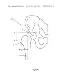 Protective Devices, Components Thereof, and Their Methods of Use diagram and image