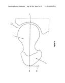 Protective Devices, Components Thereof, and Their Methods of Use diagram and image