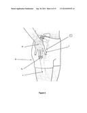 Protective Devices, Components Thereof, and Their Methods of Use diagram and image