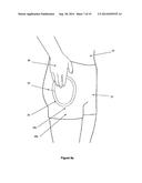 Protective Devices, Components Thereof, and Their Methods of Use diagram and image