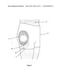 Protective Devices, Components Thereof, and Their Methods of Use diagram and image