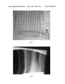 MARKING TEMPLATE FOR RADIOGRAPHY diagram and image