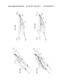 POCKET-CUTTING/SCREW-INSERTION SYSTEM WITH IMPROVED SCREW DELIVERY diagram and image