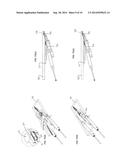 POCKET-CUTTING/SCREW-INSERTION SYSTEM WITH IMPROVED SCREW DELIVERY diagram and image