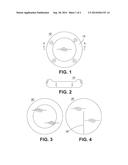 MATERIALS AND METHODS TO PREVENT LINEAR FOREIGN BODIES diagram and image