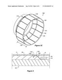 Split Foldback Rings with Anti-Hooping Band diagram and image