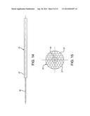 Controlled Compression Tube diagram and image