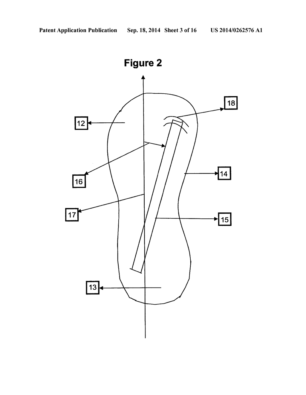 Motorized Walking Shoes - diagram, schematic, and image 04