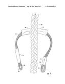 Rope Descent Device and Method diagram and image