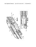 SURGICAL STAPLING APPARATUS diagram and image