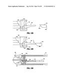 SURGICAL STAPLING APPARATUS diagram and image