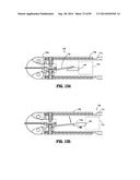 SURGICAL STAPLING APPARATUS diagram and image