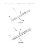 EXTENDED CURVED TIP FOR SURGICAL APPARATUS diagram and image