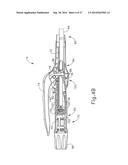 METHOD AND APPARATUS FOR SEALING END-TO-END ANASTOMOSIS diagram and image