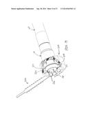 METHOD AND APPARATUS FOR SEALING END-TO-END ANASTOMOSIS diagram and image