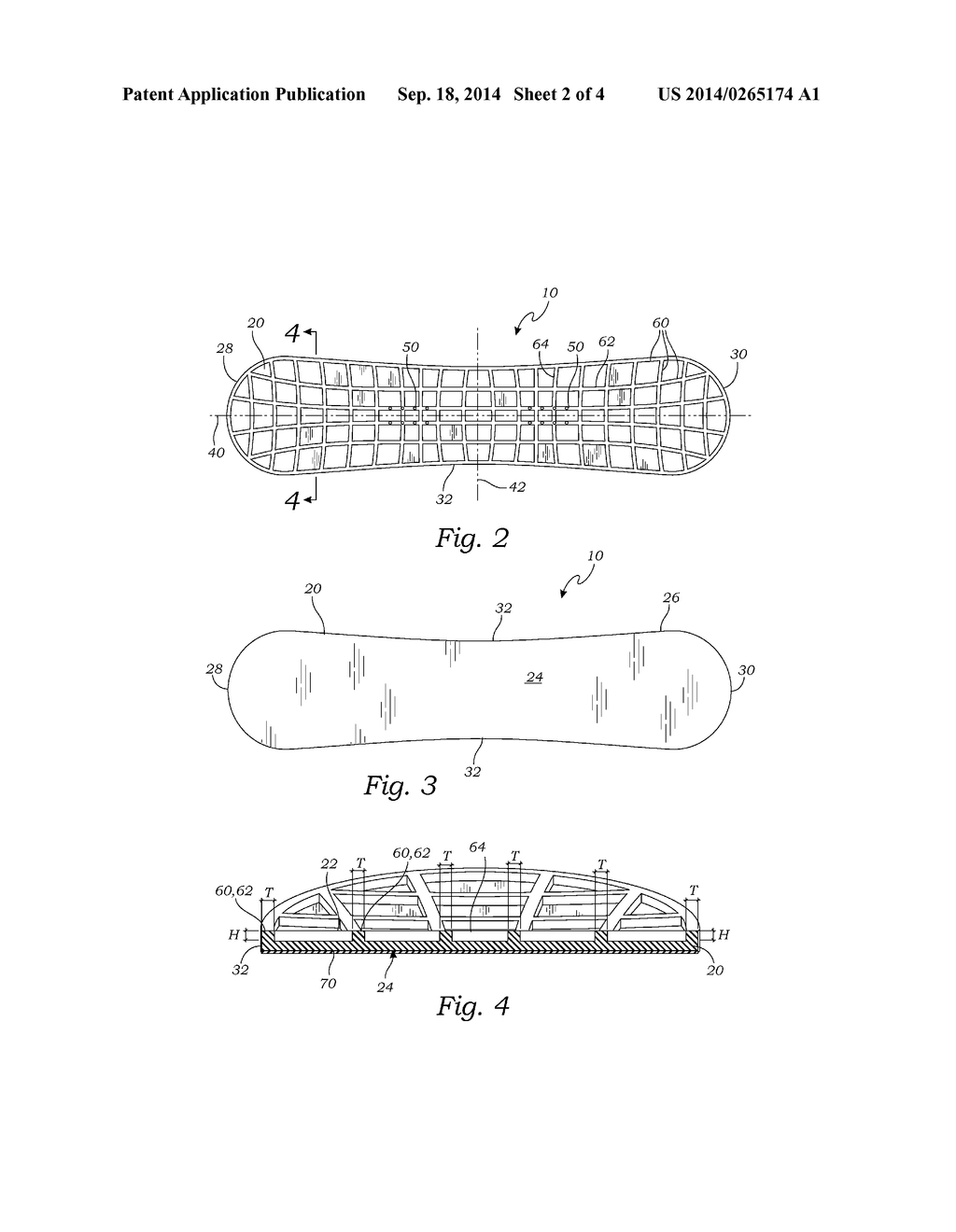 RIB-STIFFENED SPORTS BOARD - diagram, schematic, and image 03