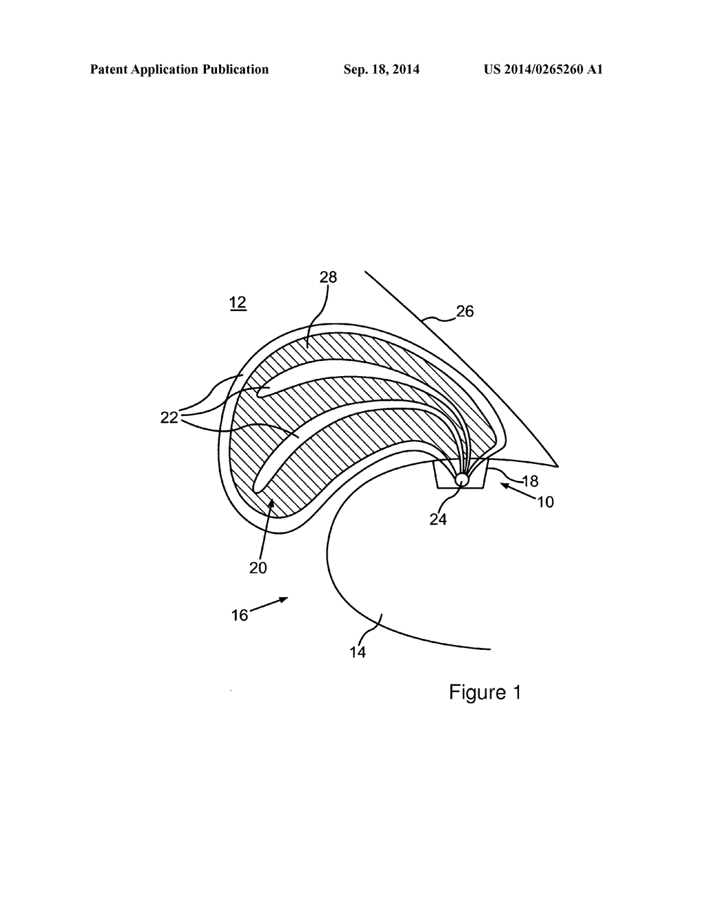 Airbag, in Particular for a Motor Vehicle - diagram, schematic, and image 02