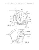 Dual Chambered Passenger Airbag diagram and image