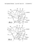 Dual Chambered Passenger Airbag diagram and image