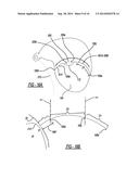 Dual Chambered Passenger Airbag diagram and image