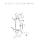 WOBBLE FREE EXTERIOR HANDLE DESIGN diagram and image