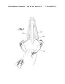 SLING BAR FOR PATIENT LIFT SLINGS diagram and image