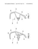 VEHICLE PILLAR CONSTRUCTION AND METHOD diagram and image