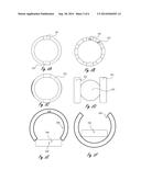 MRI SAFETY DEVICE MEANS AND METHODS THEREOF diagram and image