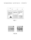 OPTIMIZING DATA RETRIEVAL FROM AN ACTIVE IMPLANTABLE MEDICAL DEVICE diagram and image