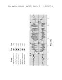 OPTIMIZING DATA RETRIEVAL FROM AN ACTIVE IMPLANTABLE MEDICAL DEVICE diagram and image