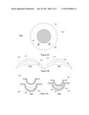 OPHTHALMIC DEVICES WITH STABILIZATION FEATURES diagram and image