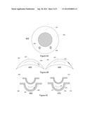 OPHTHALMIC DEVICES WITH STABILIZATION FEATURES diagram and image