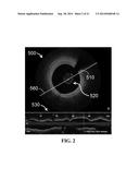 APPARATUS AND METHODS FOR OPTICAL COHERENCE TOMOGRAPHY AND TWO-PHOTON     LUMINESCENCE IMAGING diagram and image