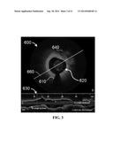 APPARATUS AND METHODS FOR OPTICAL COHERENCE TOMOGRAPHY AND TWO-PHOTON     LUMINESCENCE IMAGING diagram and image