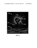 APPARATUS AND METHODS FOR OPTICAL COHERENCE TOMOGRAPHY AND TWO-PHOTON     LUMINESCENCE IMAGING diagram and image