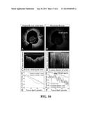 APPARATUS AND METHODS FOR OPTICAL COHERENCE TOMOGRAPHY AND TWO-PHOTON     LUMINESCENCE IMAGING diagram and image