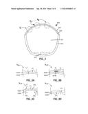 REMOTE LUMIPHOR SOLID STATE LIGHTING DEVICES WITH ENHANCED LIGHT     EXTRACTION diagram and image