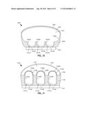 REMOTE LUMIPHOR SOLID STATE LIGHTING DEVICES WITH ENHANCED LIGHT     EXTRACTION diagram and image