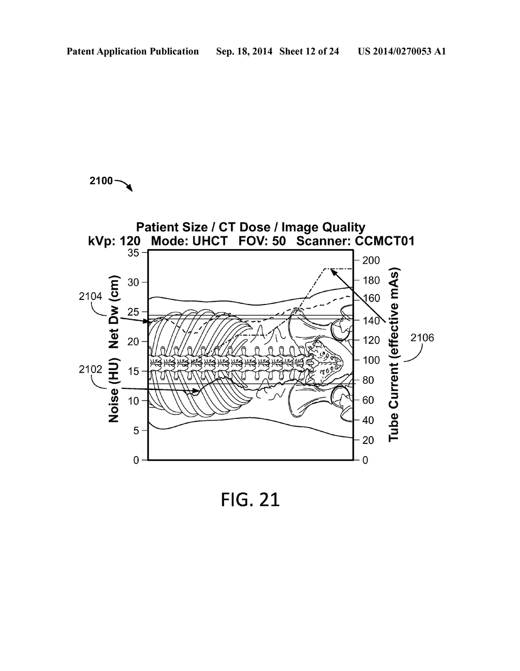 Method for Consistent and Verifiable Optimization of Computed Tomography     (CT) Radiation Dose - diagram, schematic, and image 13