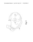 APPARATUS AND METHOD FOR CALIBRATING AN X-RAY IMAGE OF A KNEE OF A PATIENT diagram and image