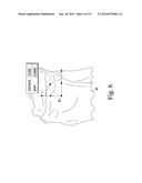 APPARATUS AND METHOD FOR CALIBRATING AN X-RAY IMAGE OF A KNEE OF A PATIENT diagram and image