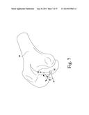 APPARATUS AND METHOD FOR CALIBRATING AN X-RAY IMAGE OF A KNEE OF A PATIENT diagram and image